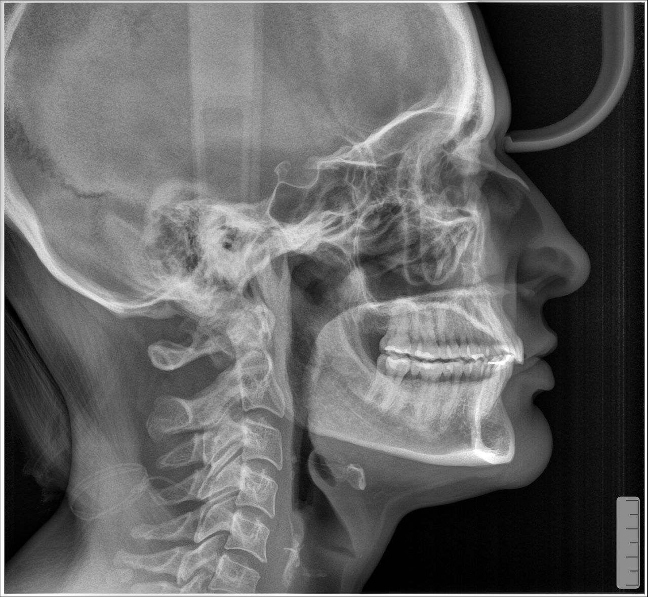 Ruben Patier Martin-37