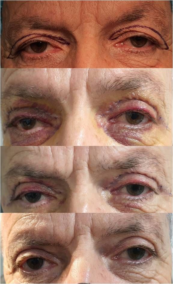 Telmo Xabier Lertxundi Plaza-14