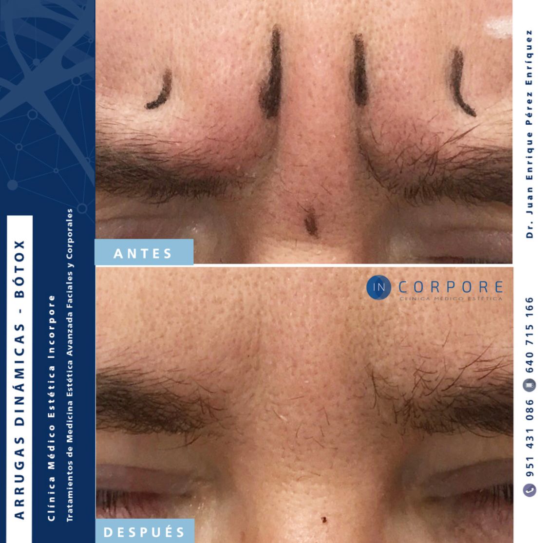 Juan Enrique Pérez Enríquez-81