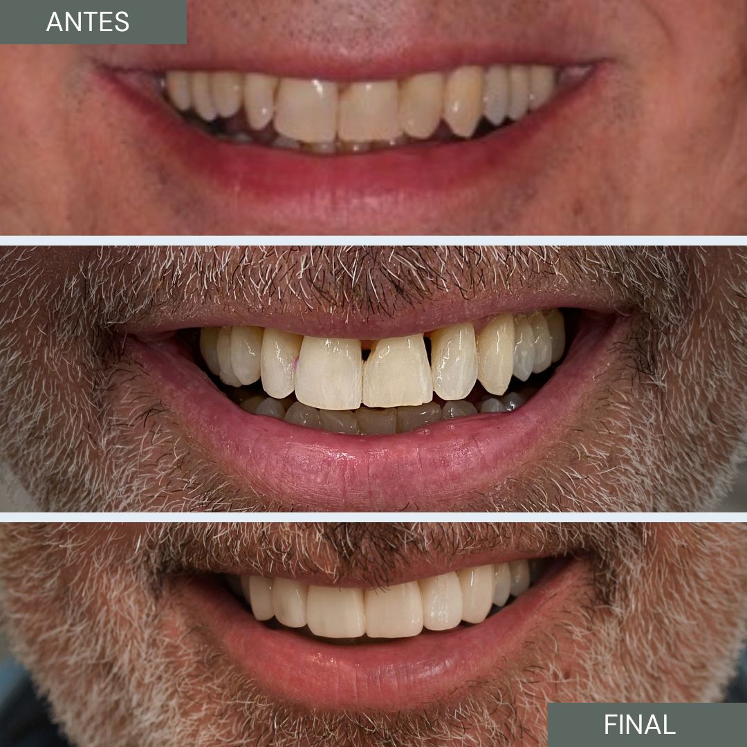 Marien Morata Roig-24