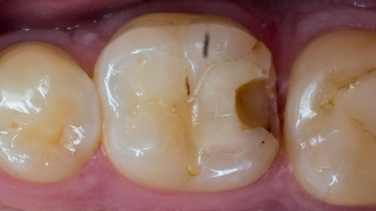 Volodymyr Kachmar-19