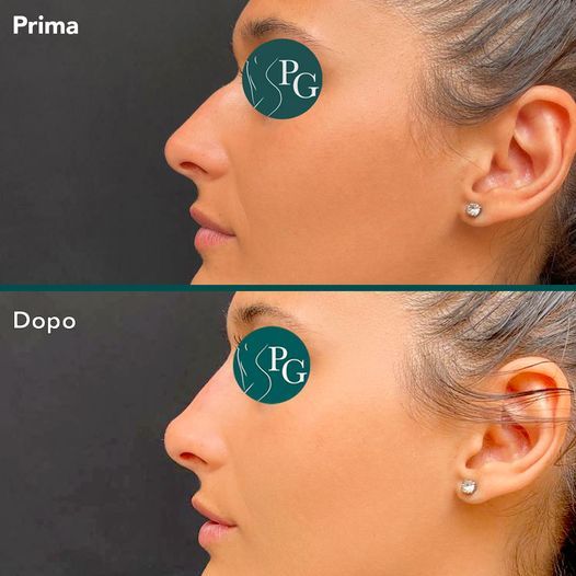 Pasquale Graziano-10