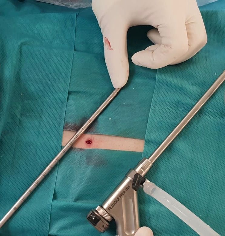 Juan Camilo Hernandez Acevedo-33