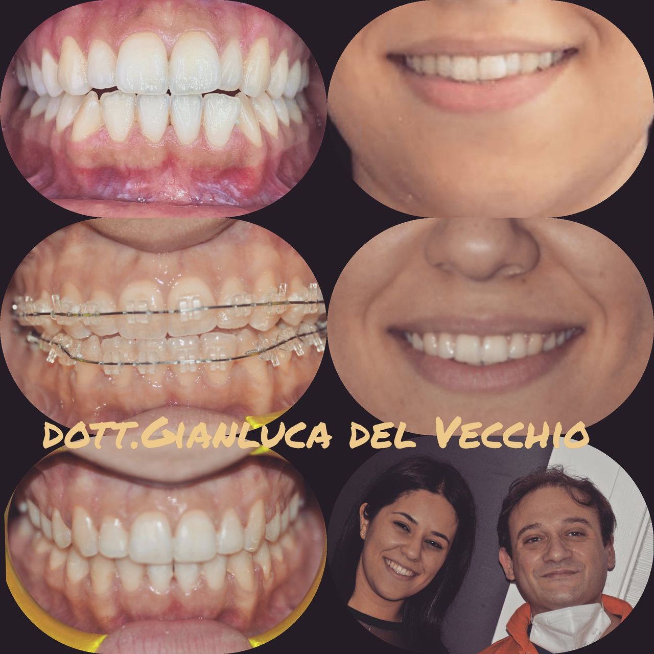 Gianluca Del Vecchio-53