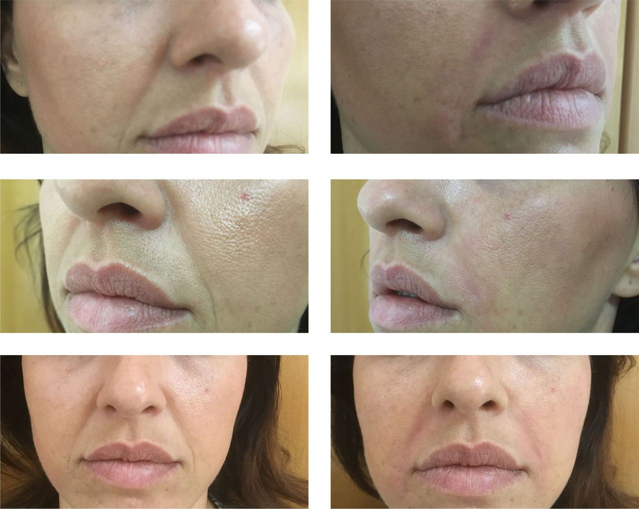 Virginia Cristina Rapisarda-43