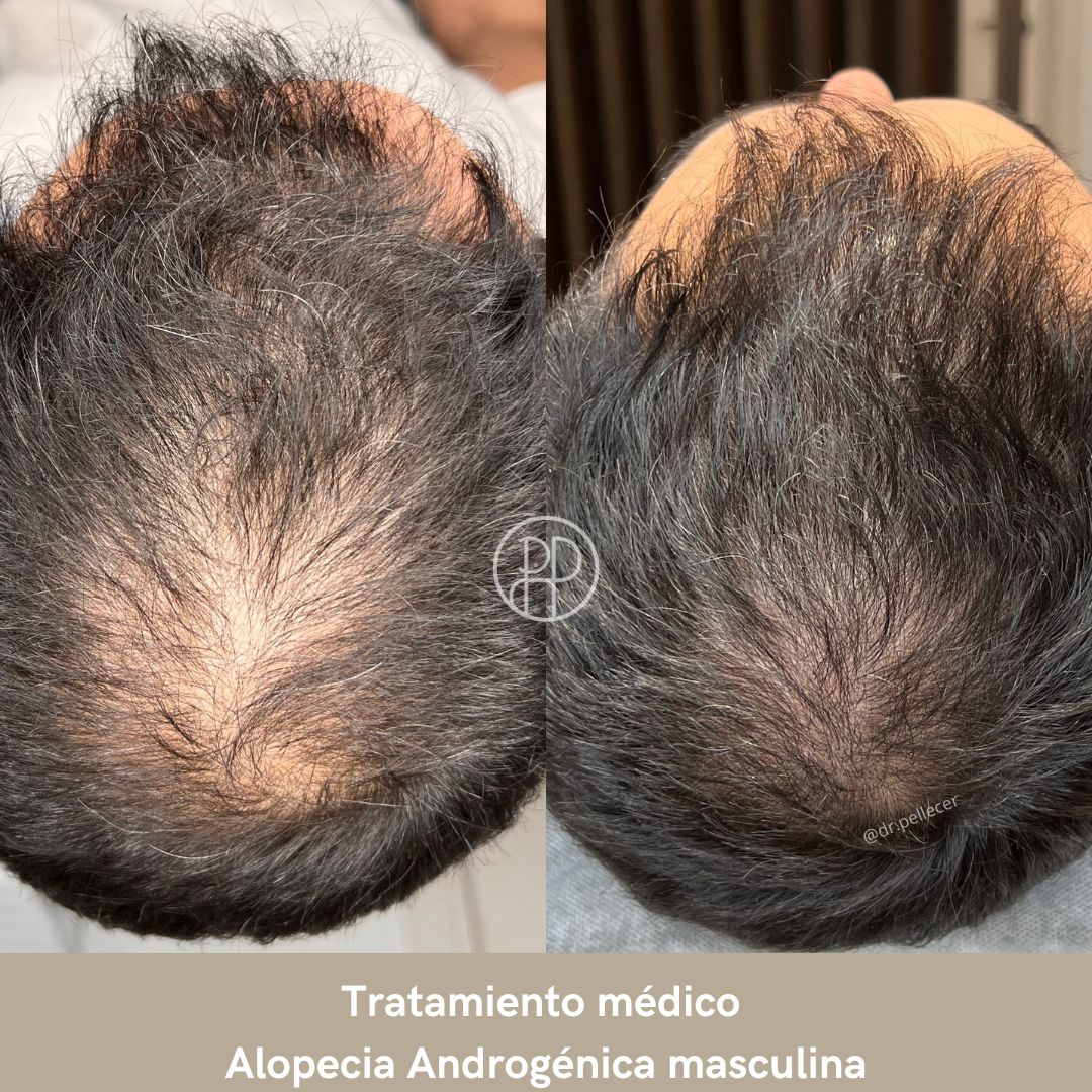 Liliana Paola Pellecer Ruiz-2