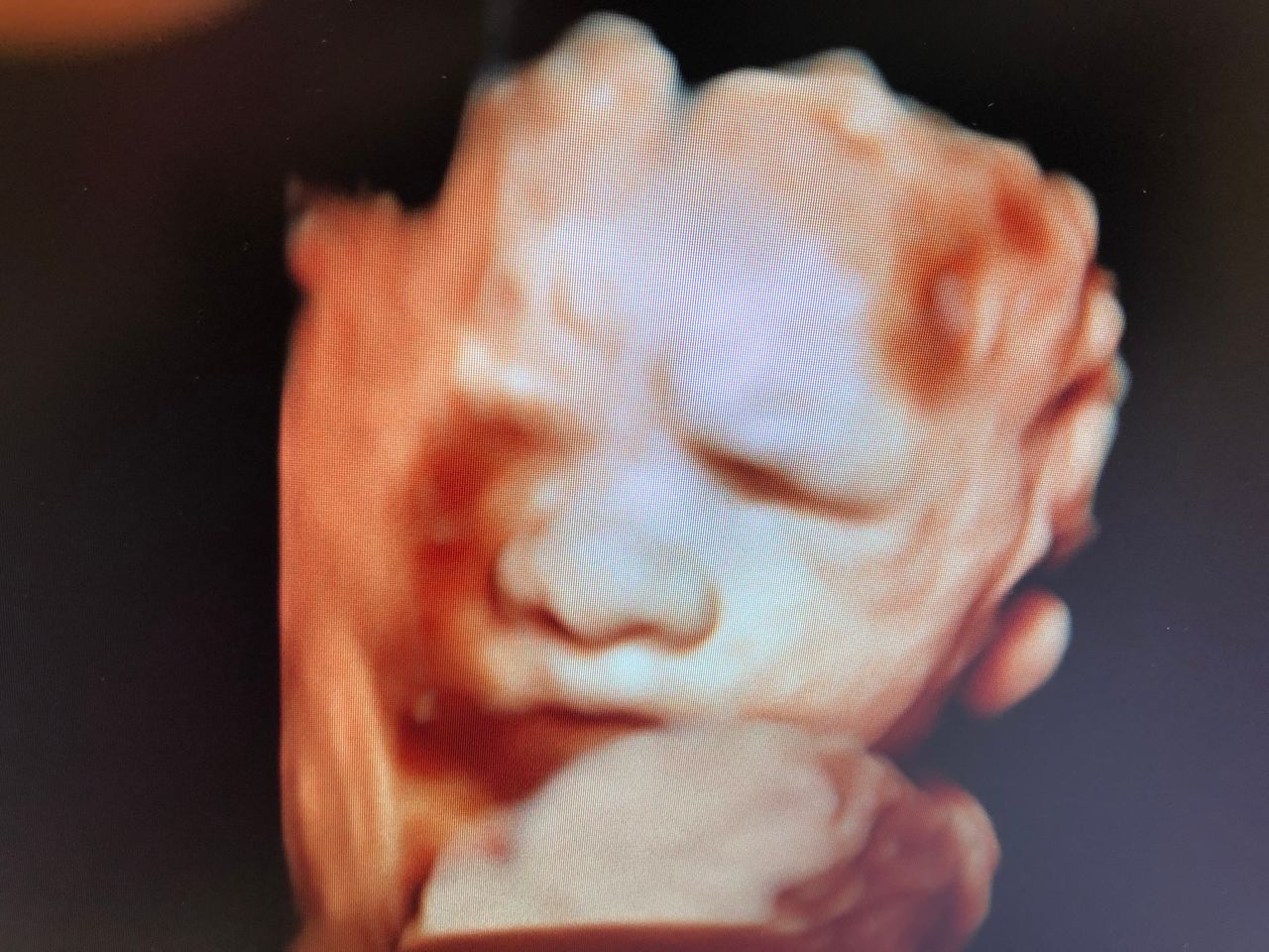 Katarzyna Leszczyńska-10