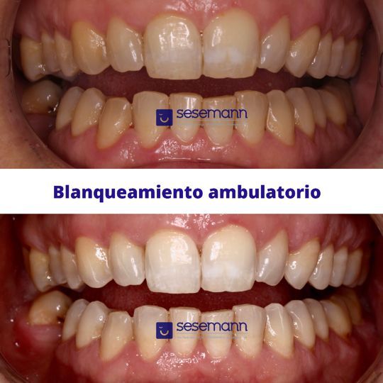 Paula Cano Carrillo-85