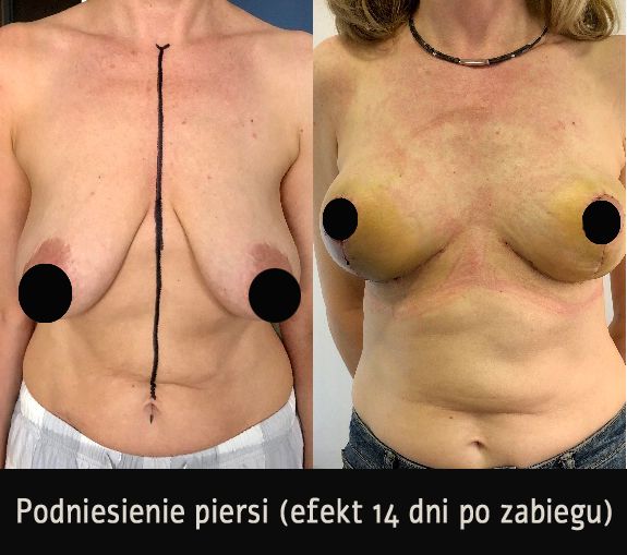 Mariusz Zagajewski-28