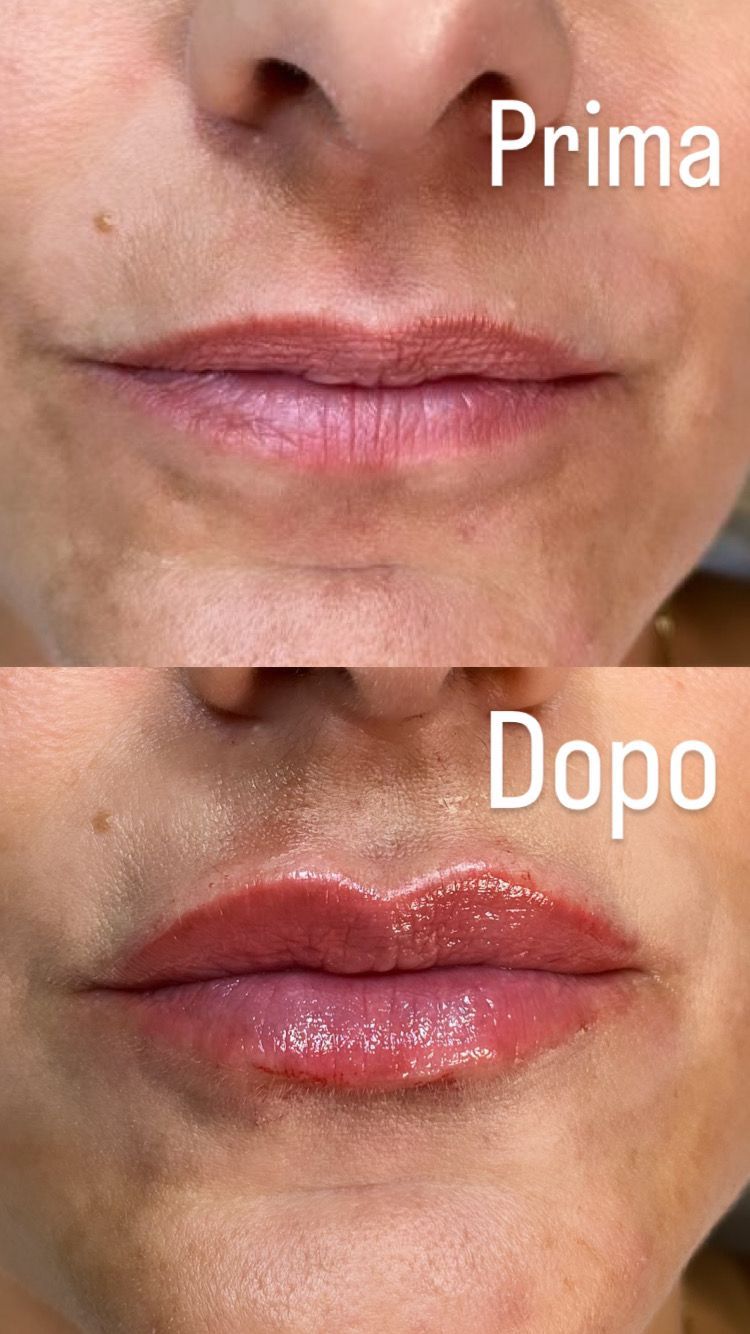 Alberto Alessandri-4