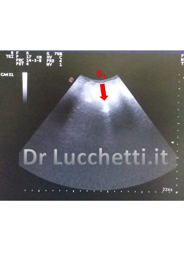 Francesco Lucchetti-1