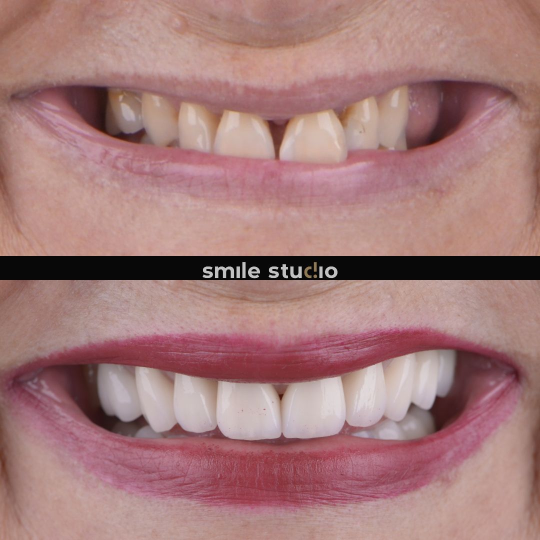 Michał Jankowski-24