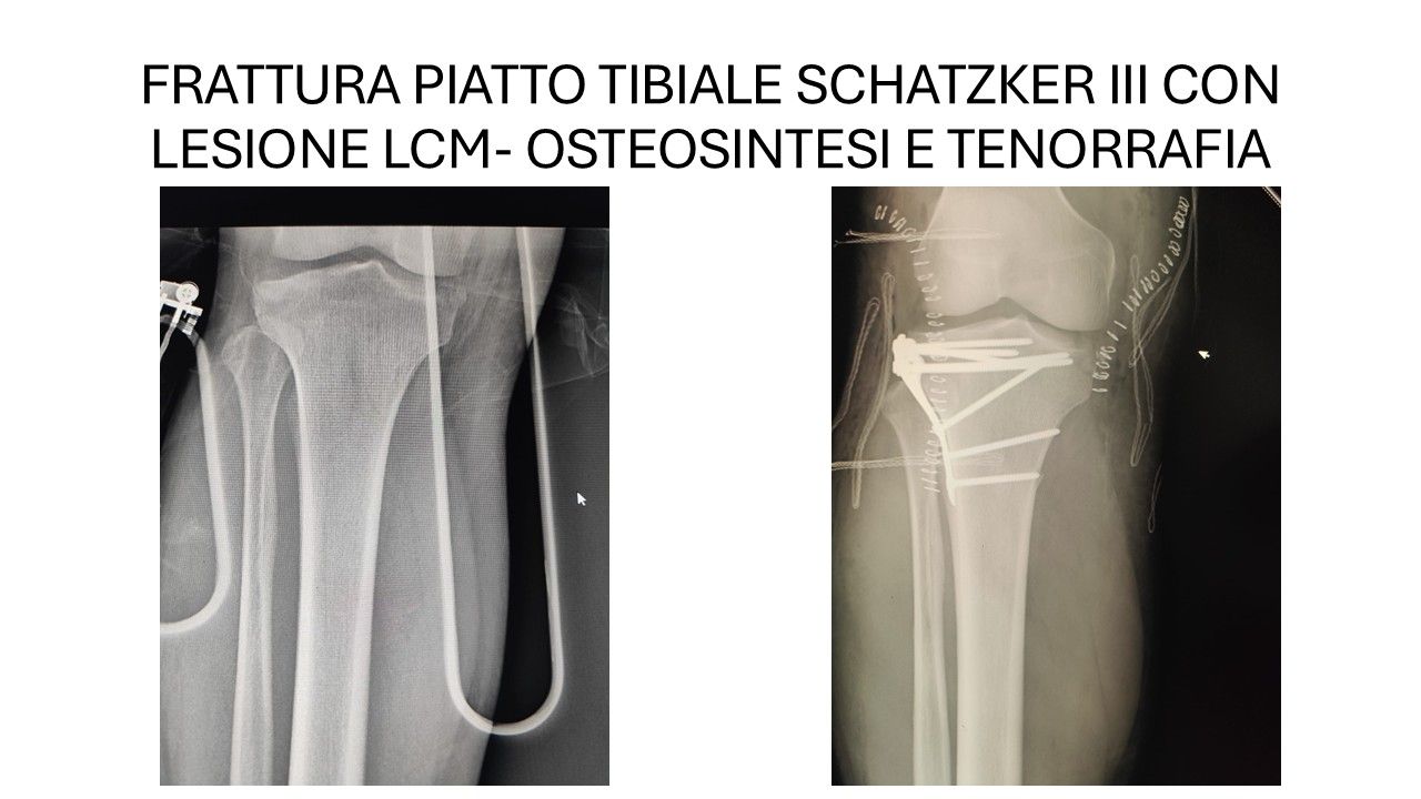 Bartolomeo D'amora-11