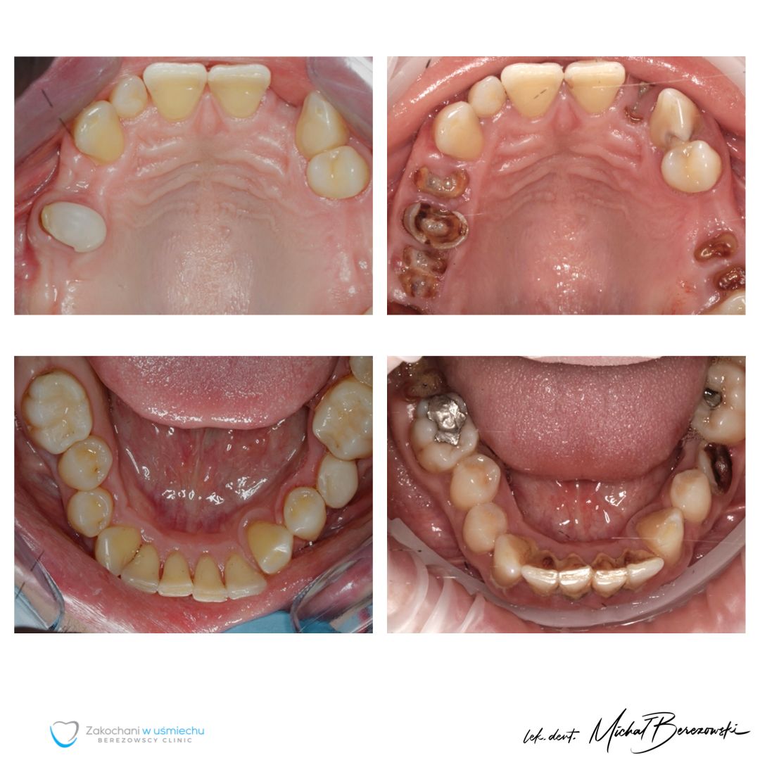 Michał Berezowski-47