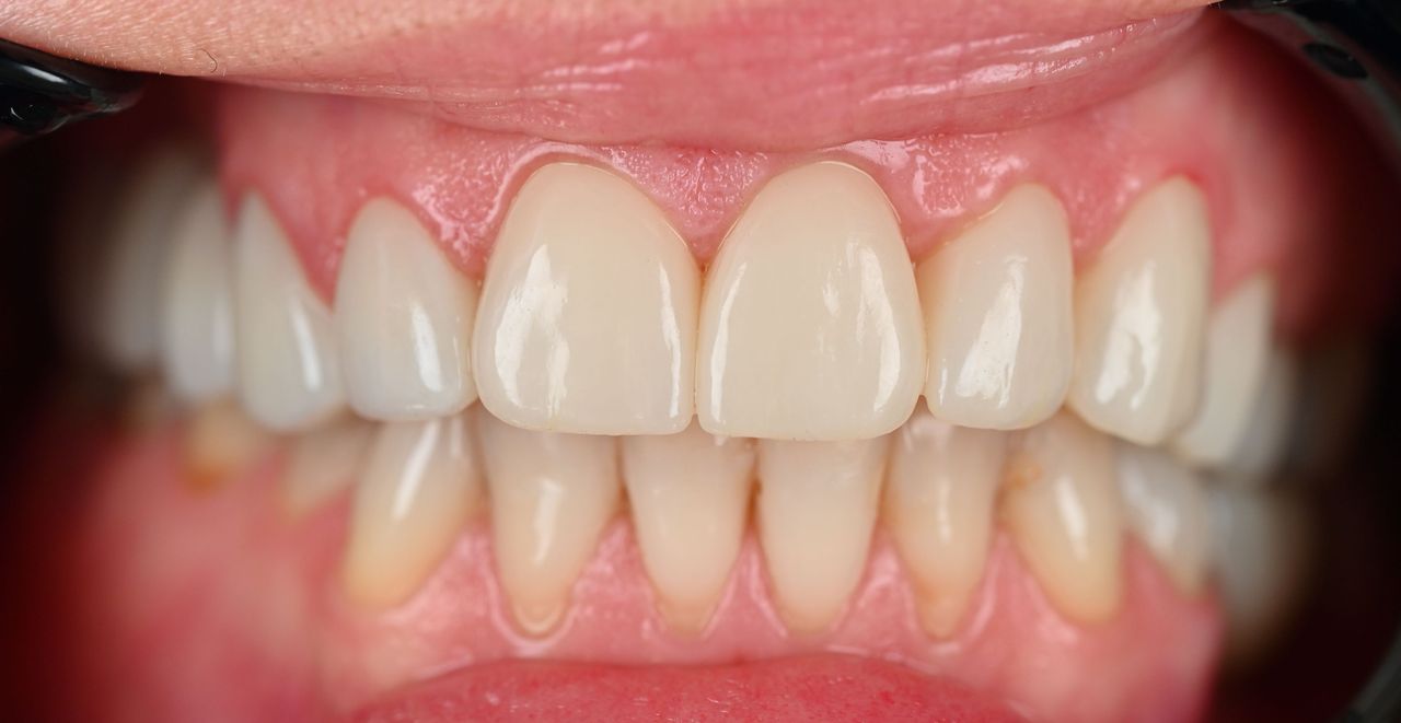 Magdalena Bińkowska-10