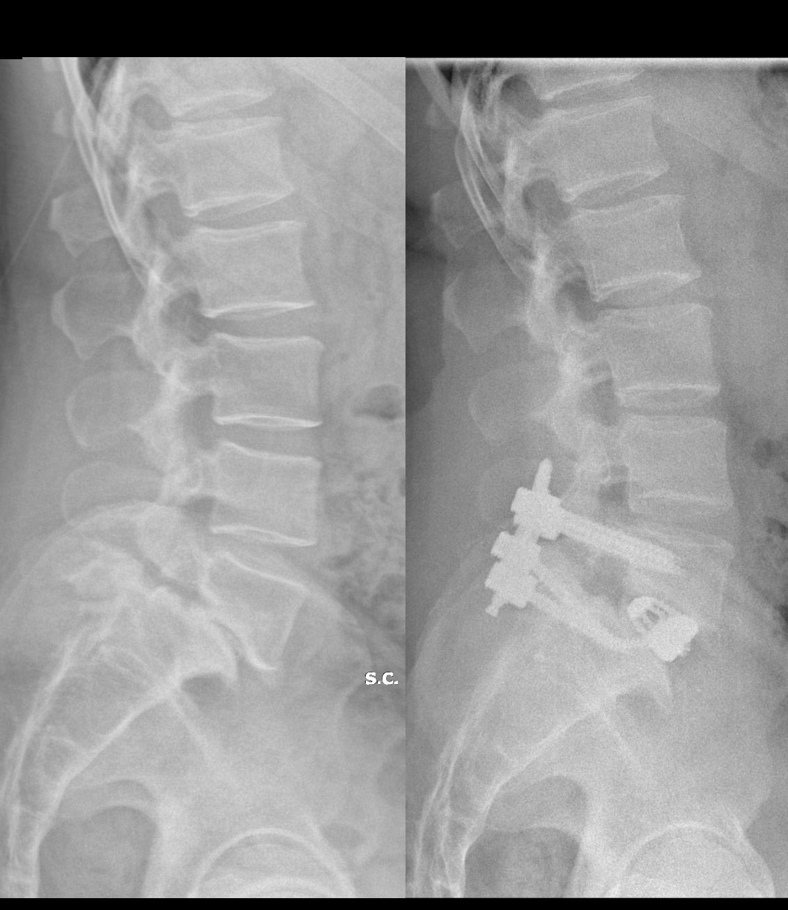 Federico Caporlingua-4