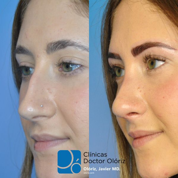 Javier Oloriz Marin-15