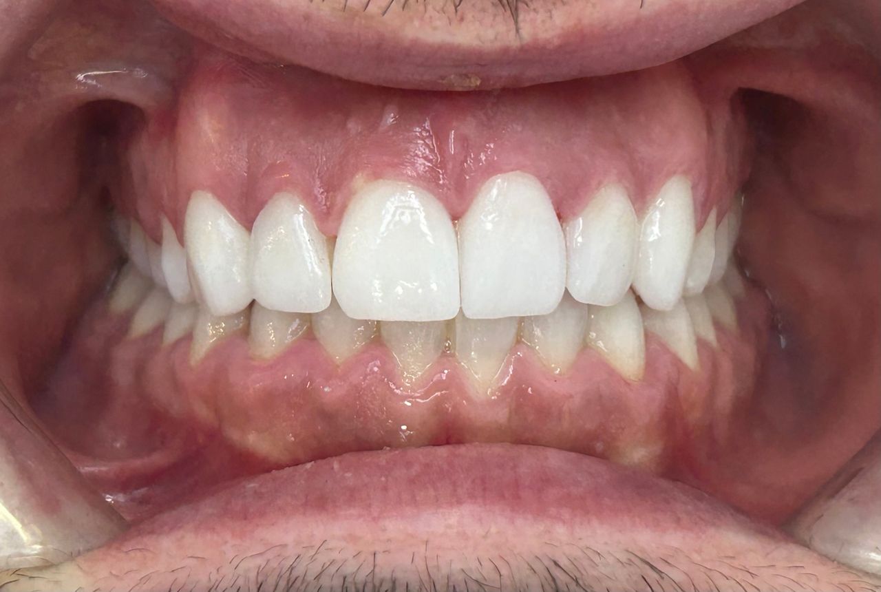 César Buján Riveiro-7