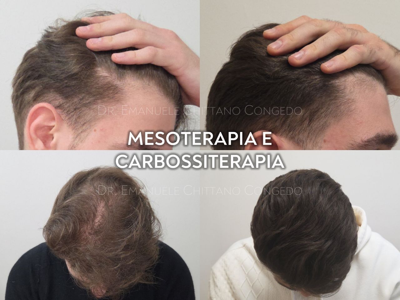 Emanuele Chittano Congedo-0