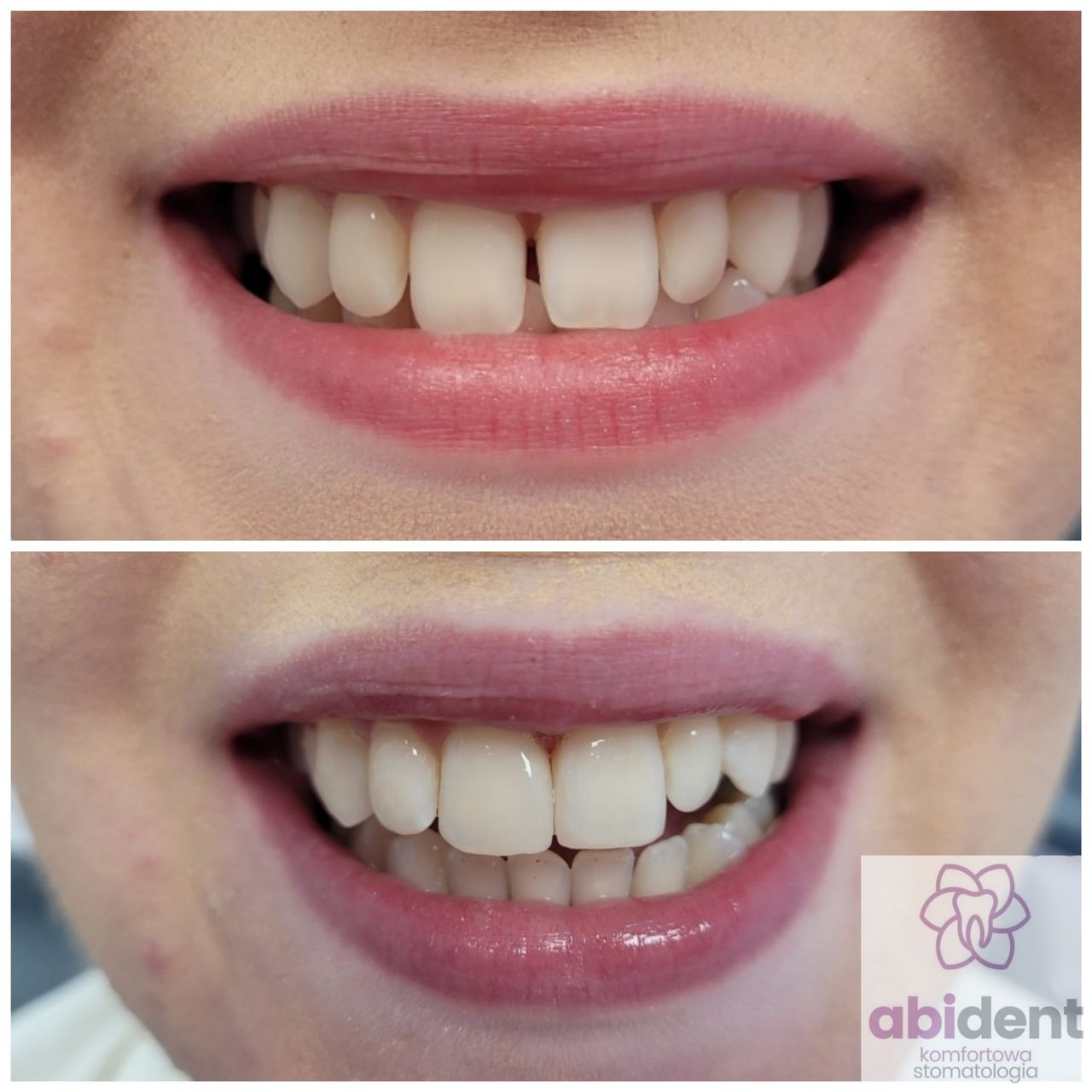 Katarzyna Korfanty-4