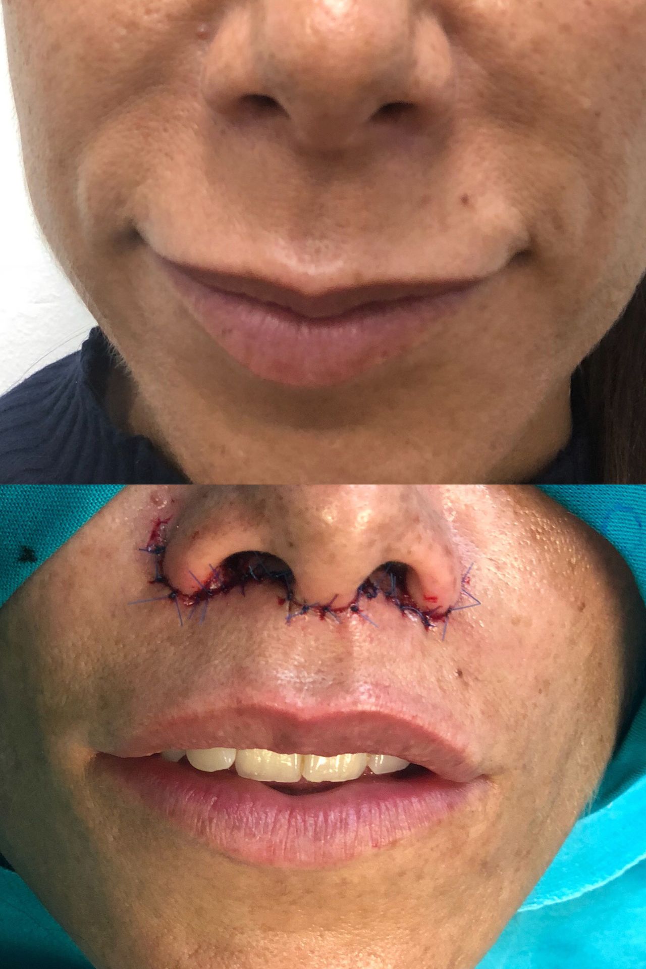 Alberto Candau Álvarez-40