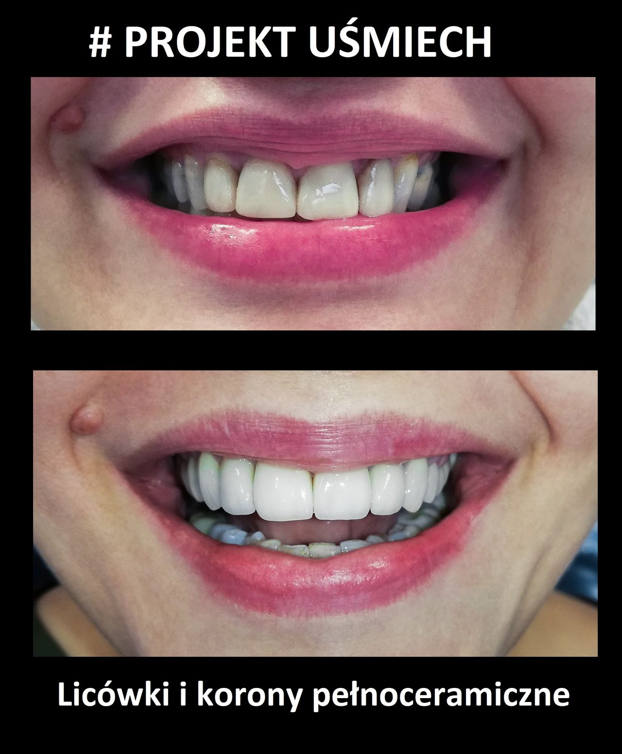 Bartosz Łukasiewicz-5