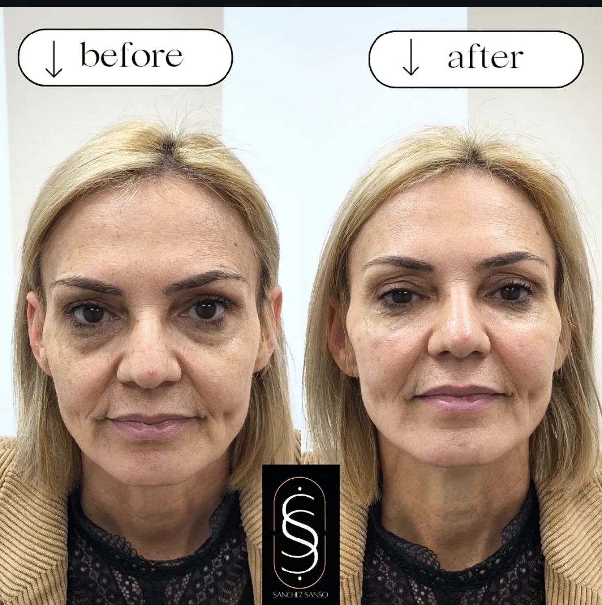 Matías Sánchez Sansó-5