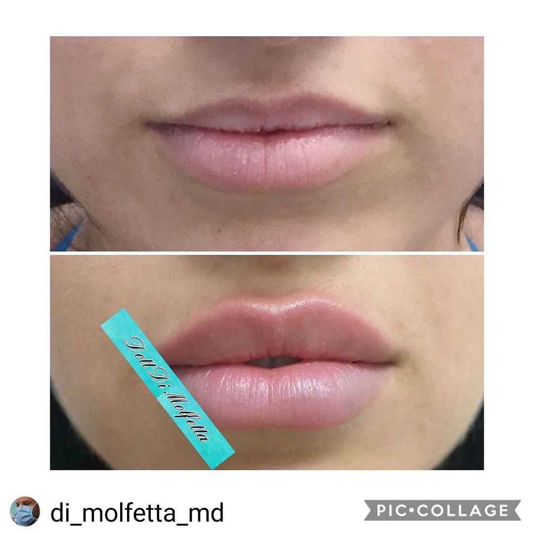 Pasquale Di Molfetta-19