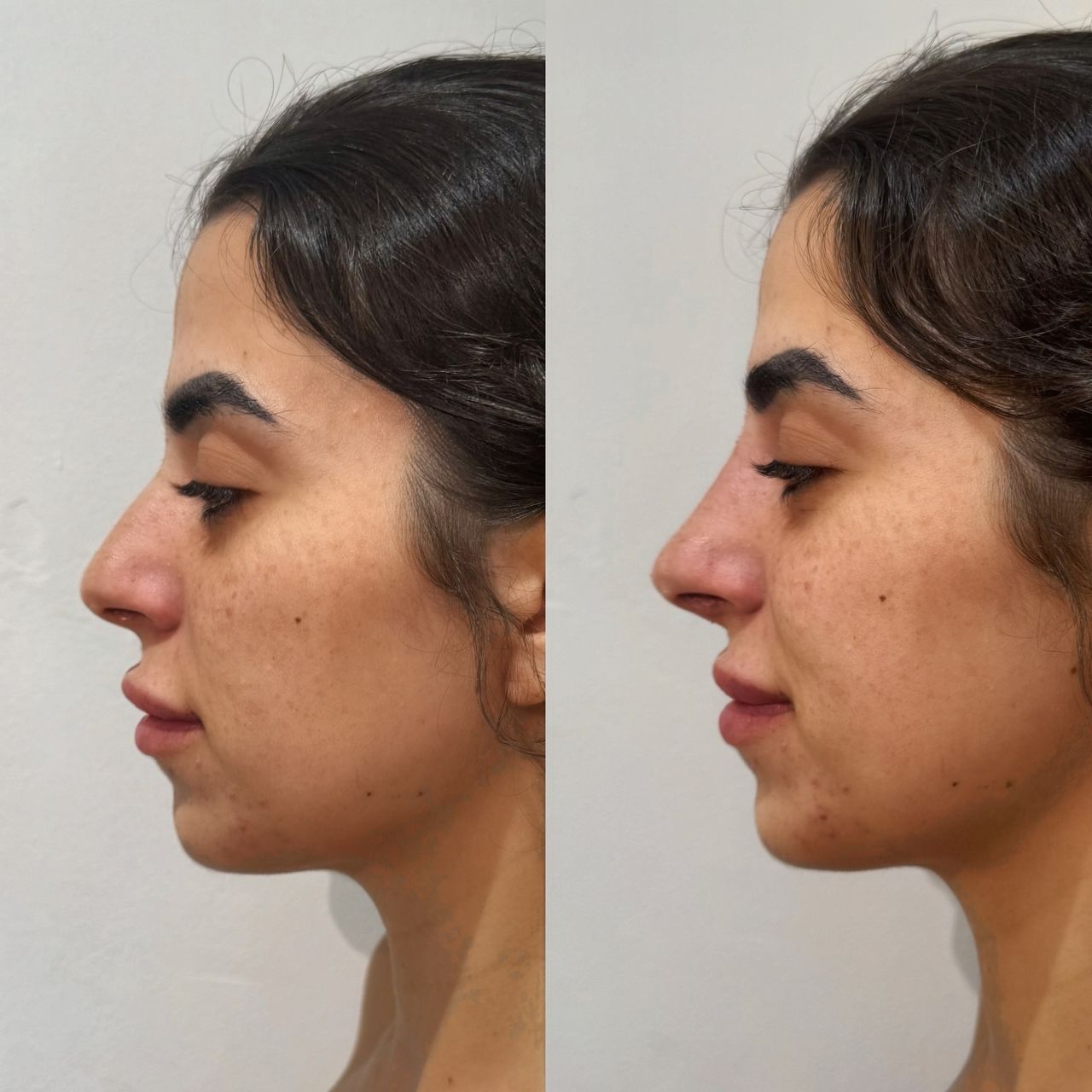 Andrea Catahysa Del Torto-2