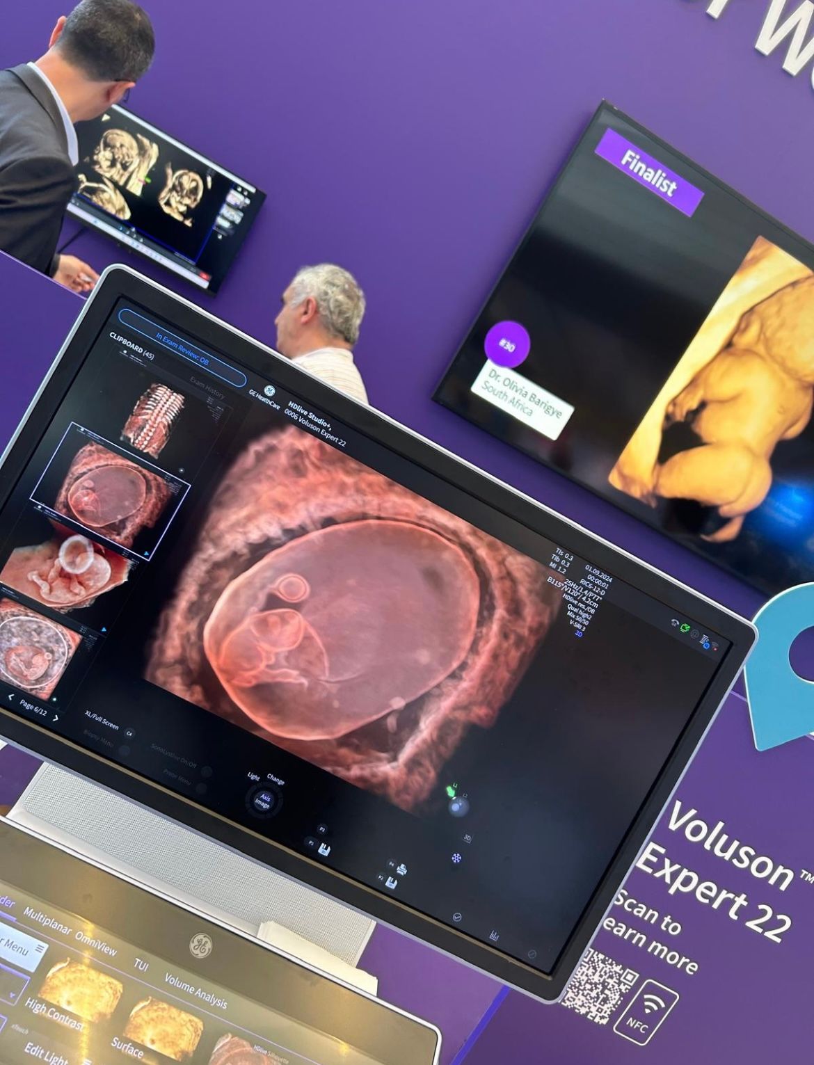 Wioletta Rozmus-Warcholińska-202