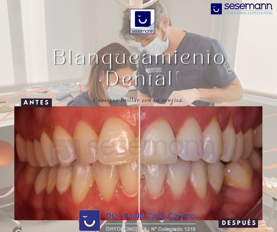 Paula Cano Carrillo-18