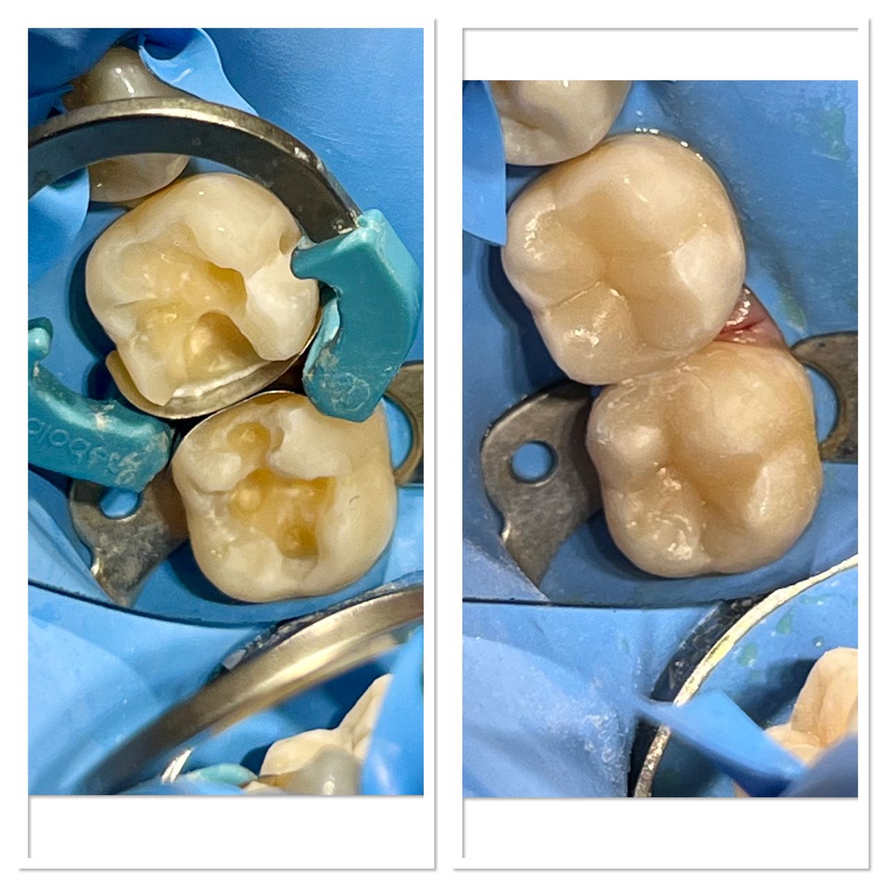 Anna Chmielecka-Borusewicz-8