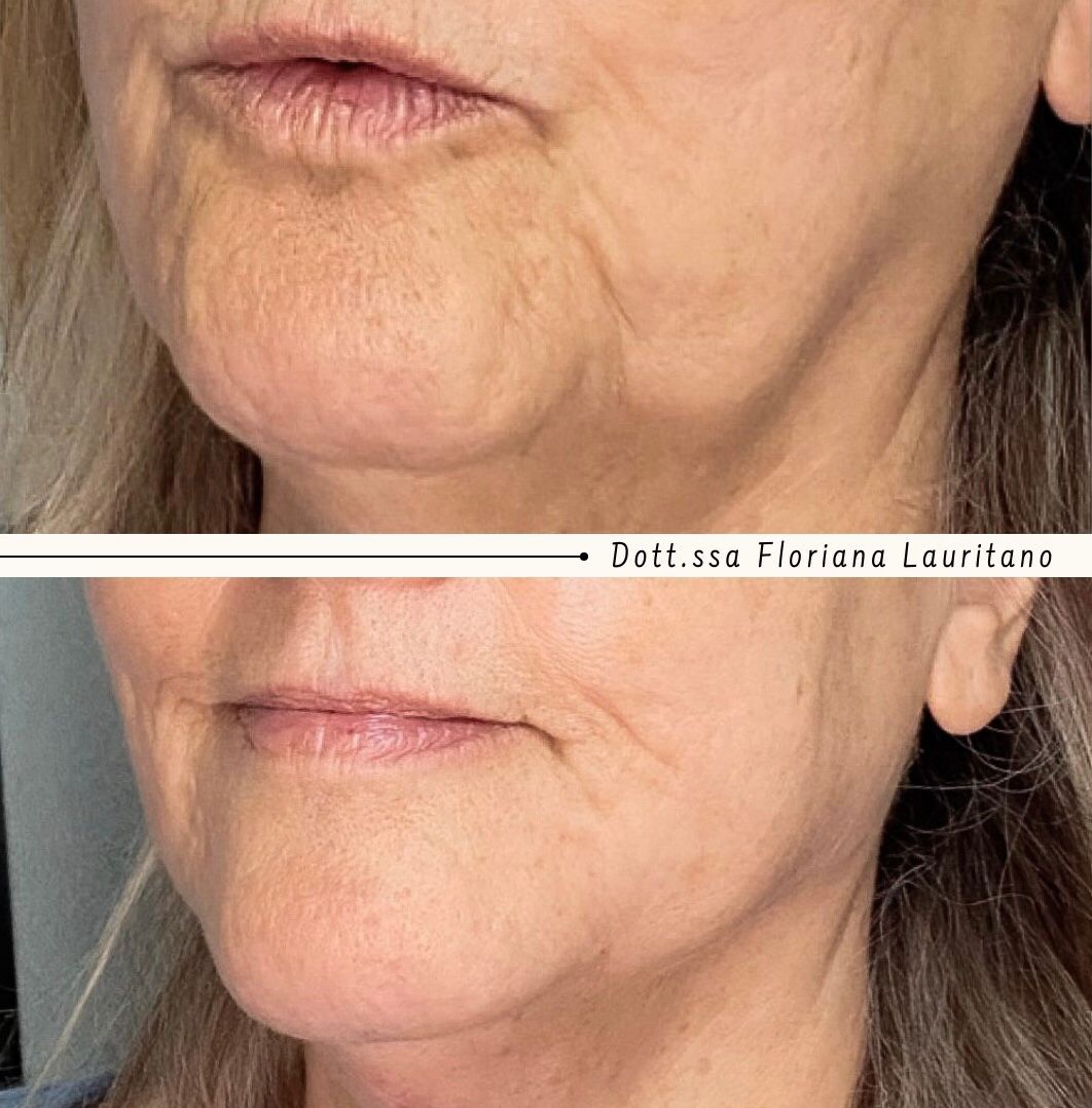 Floriana Lauritano-21