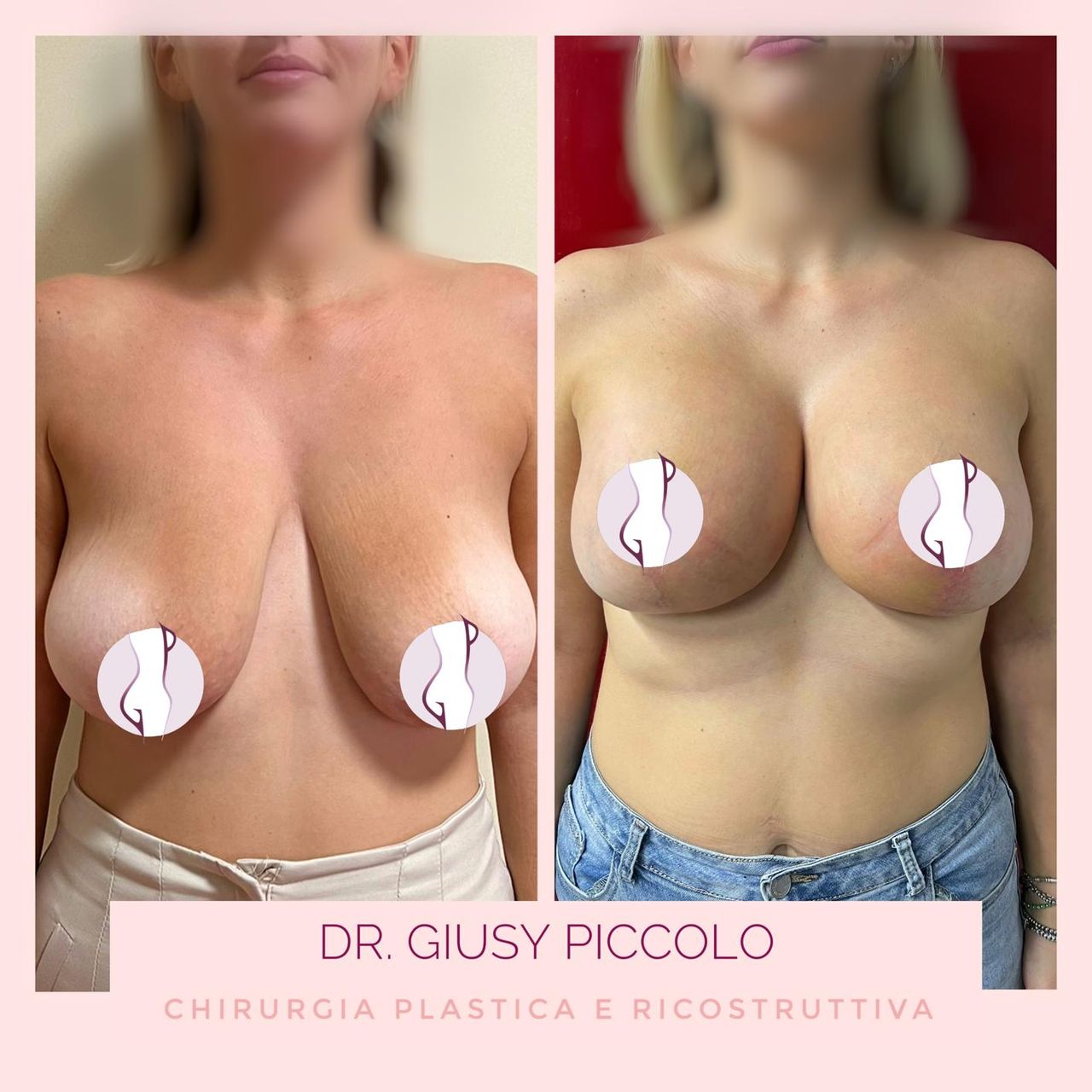 Giuseppina Piccolo-18