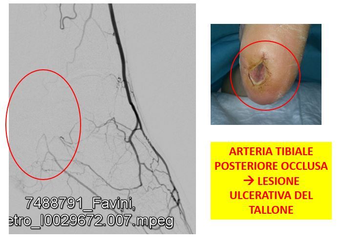 Gianni De Angelis-16