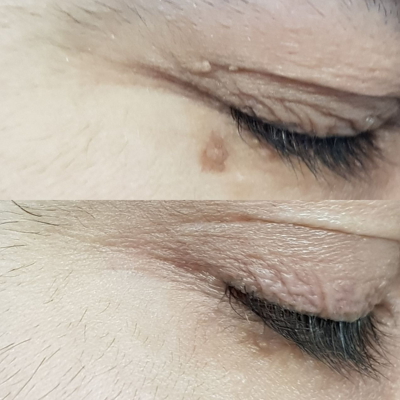 Rosalba Herrero Zerpa-204