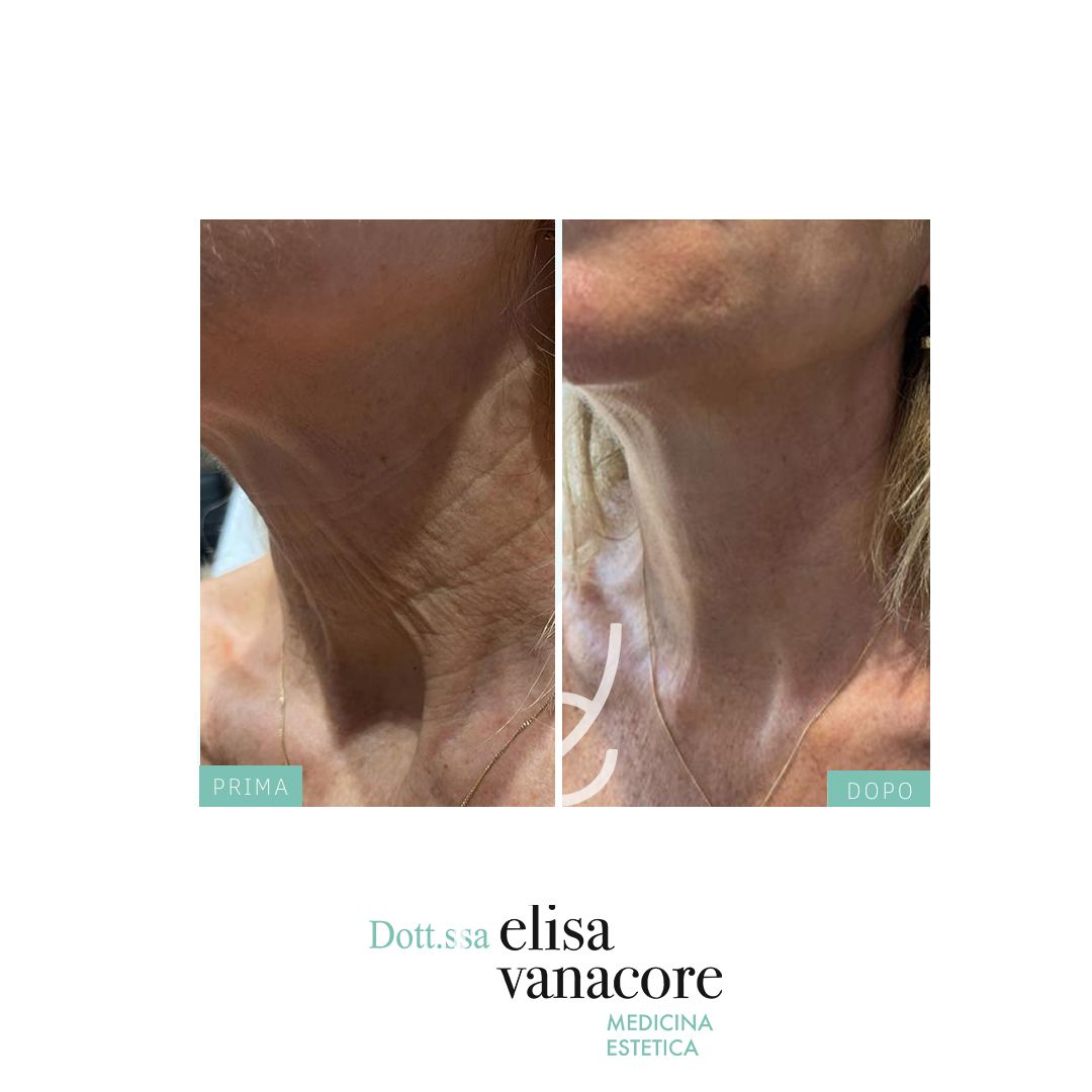 Elisa Vanacore-32