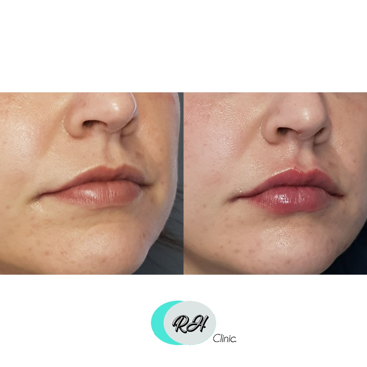 Rosalba Herrero Zerpa-101