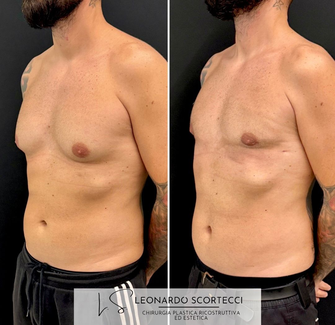 Leonardo Scortecci-8