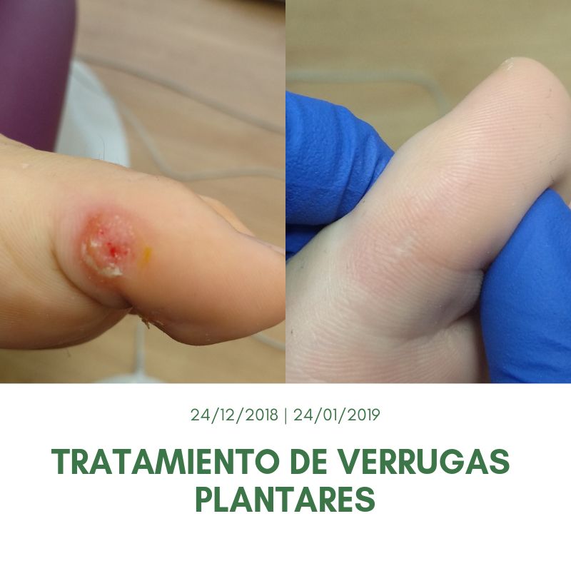 Salomé Antón Arnal-34