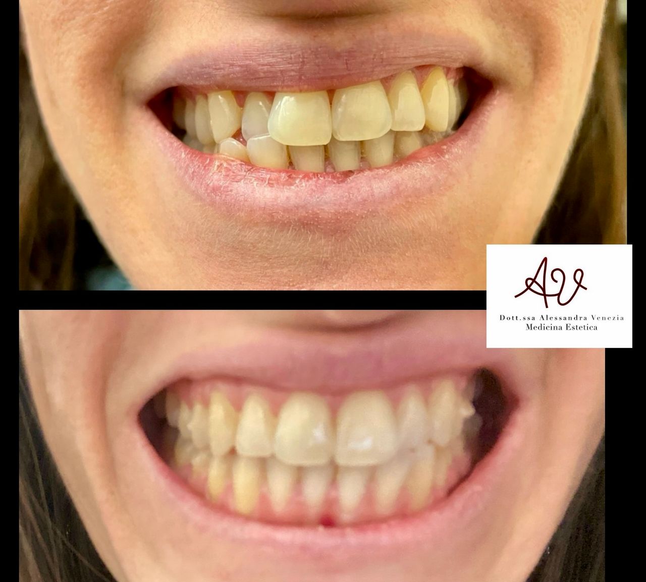 Alessandra Venezia-20