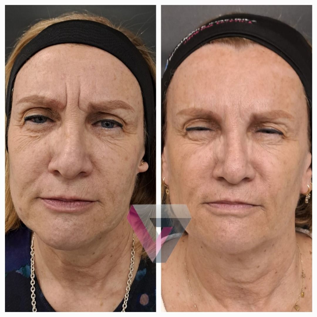 Victoria Trasmonte-130