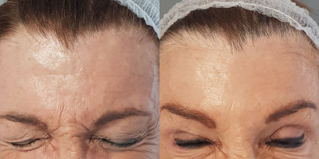 Rosalba Herrero Zerpa-496