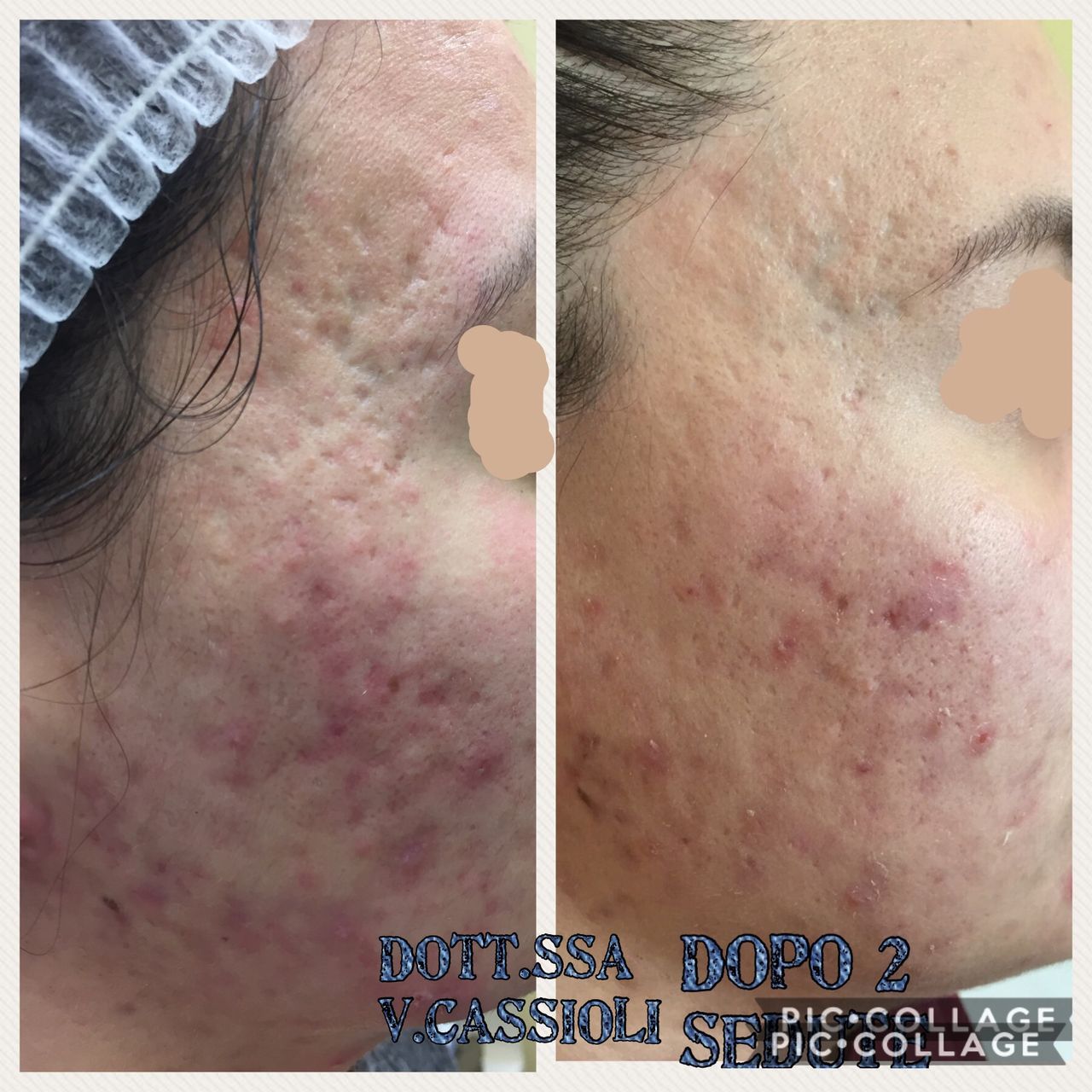 Vittoria Cassioli-57