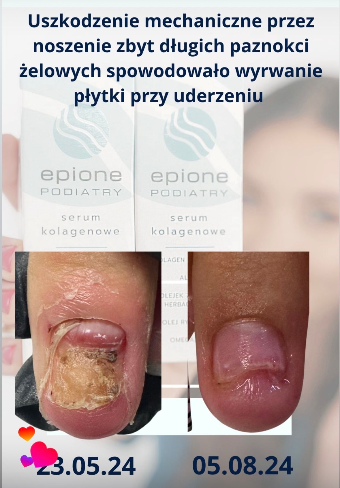 Karolina Colonna-Walewska-10