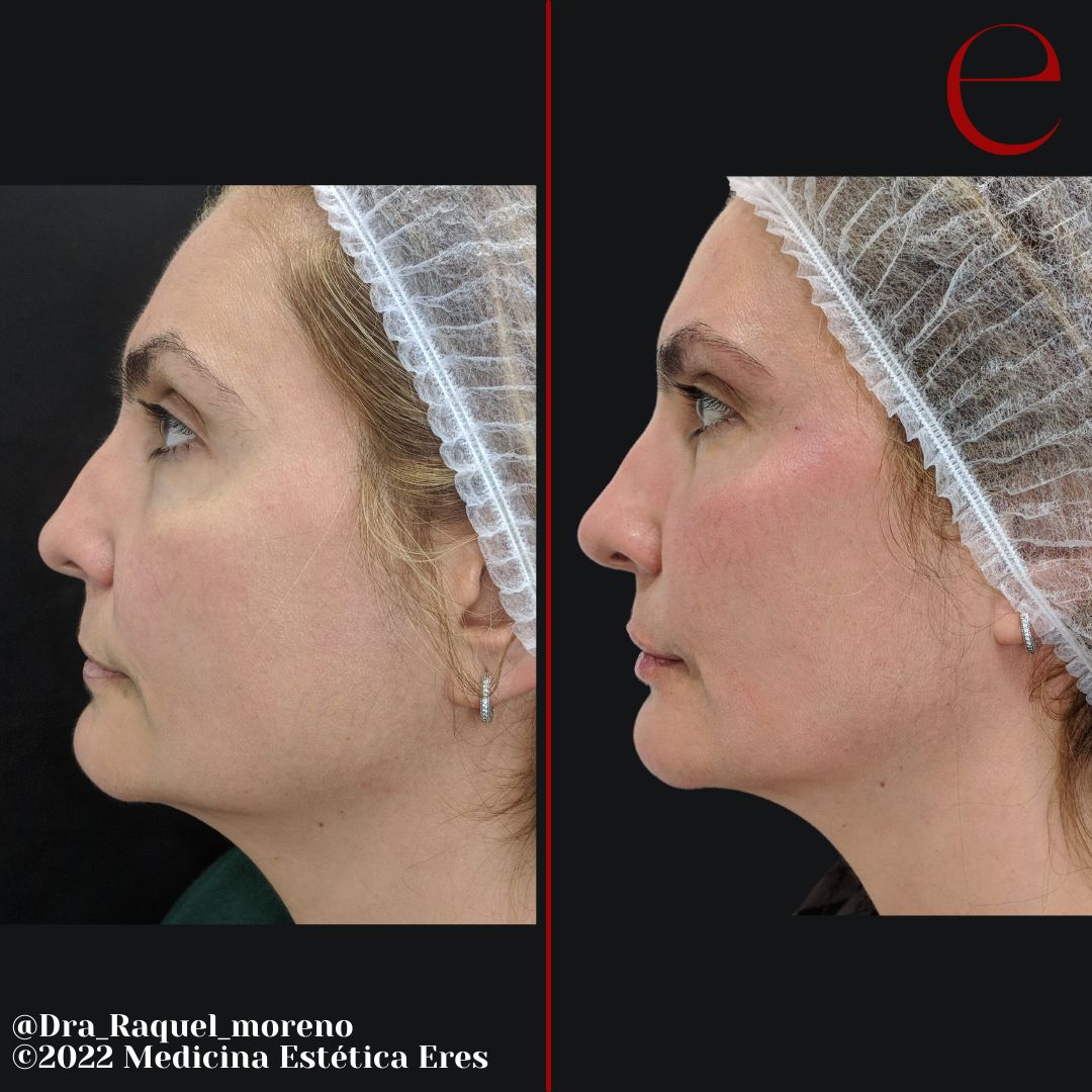 Raquel Moreno Pentinel-86