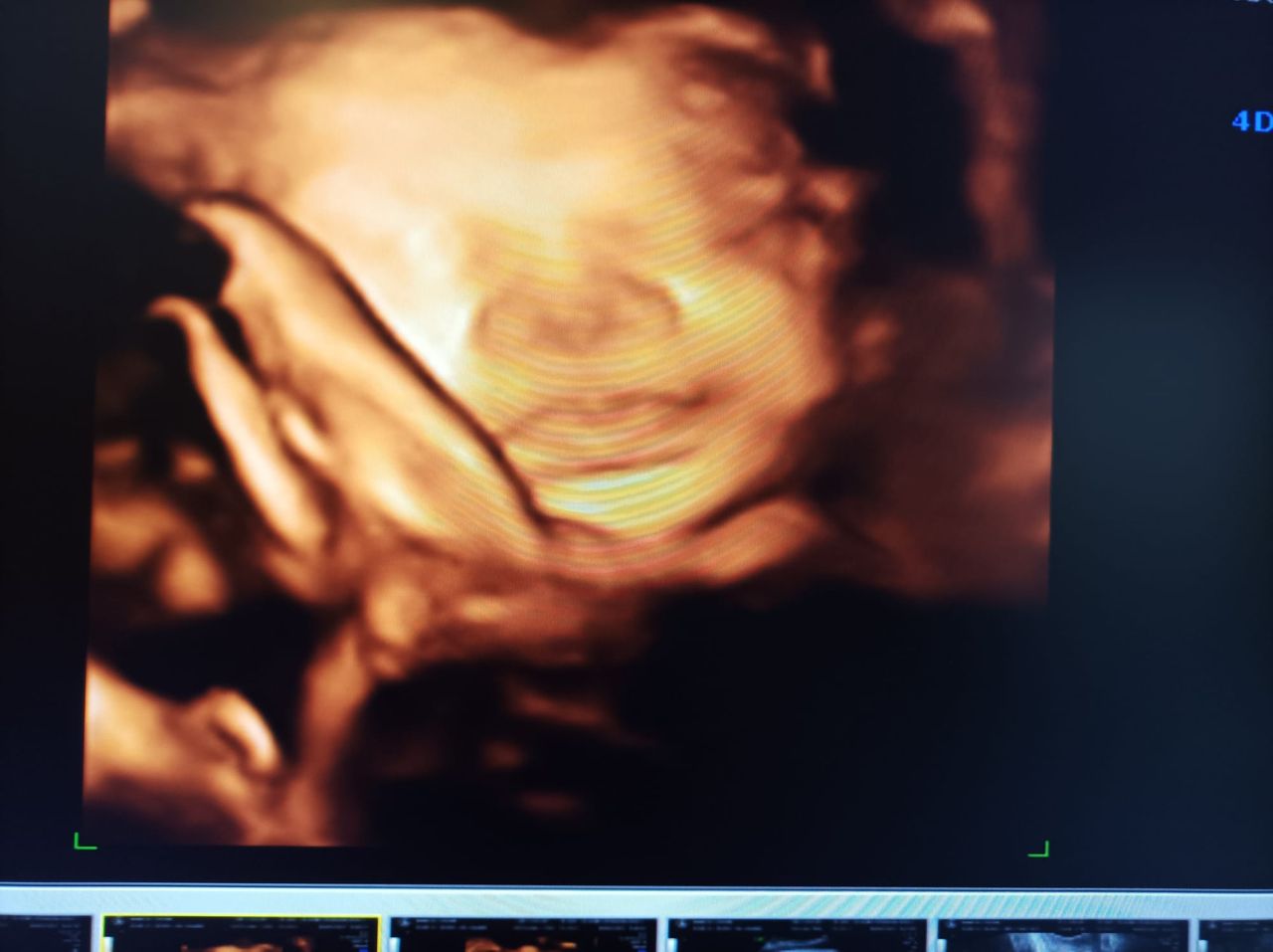 Medine Meltem Adalıoğlu-5