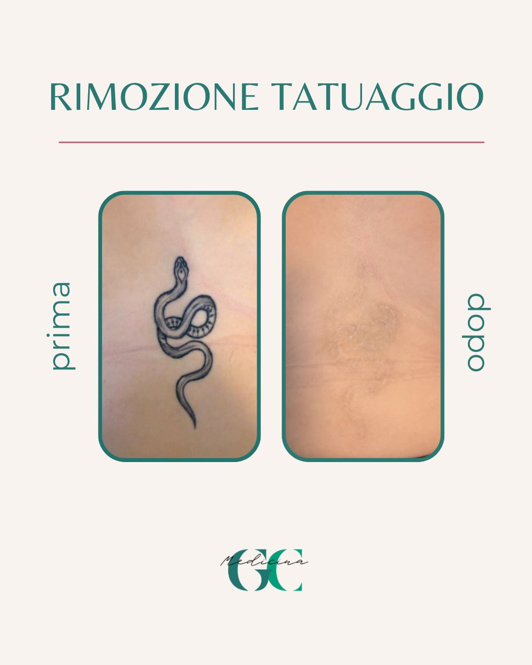 Giacomo Casale-27