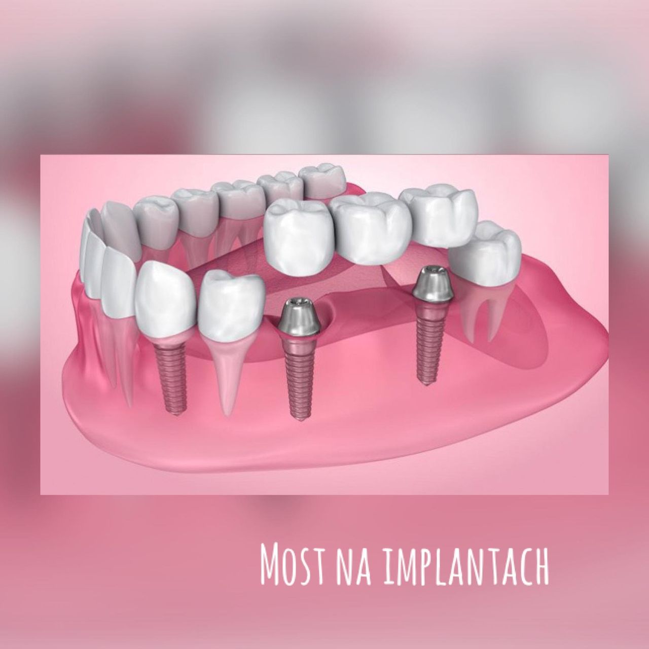 Karolina Anna Kownacka-7