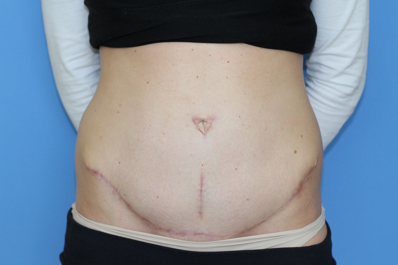 Maciej Charaziński-139